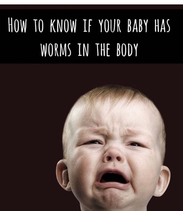 How to know if your baby has worms in the body How to know if your baby has worms in the body