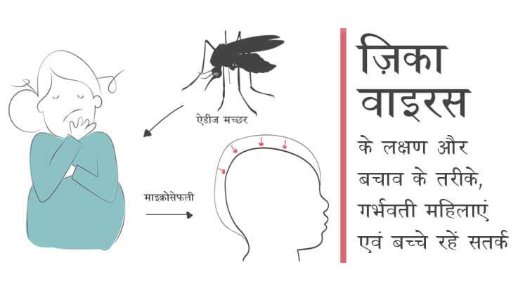 जानिए जीका वायरस के लक्षण और बचाव के 7 तरीके गर्भवती महिलाएं के लिए जानिए जीका वायरस के लक्षण और बचाव के 7 तरीके गर्भवती महिलाएं के लिए