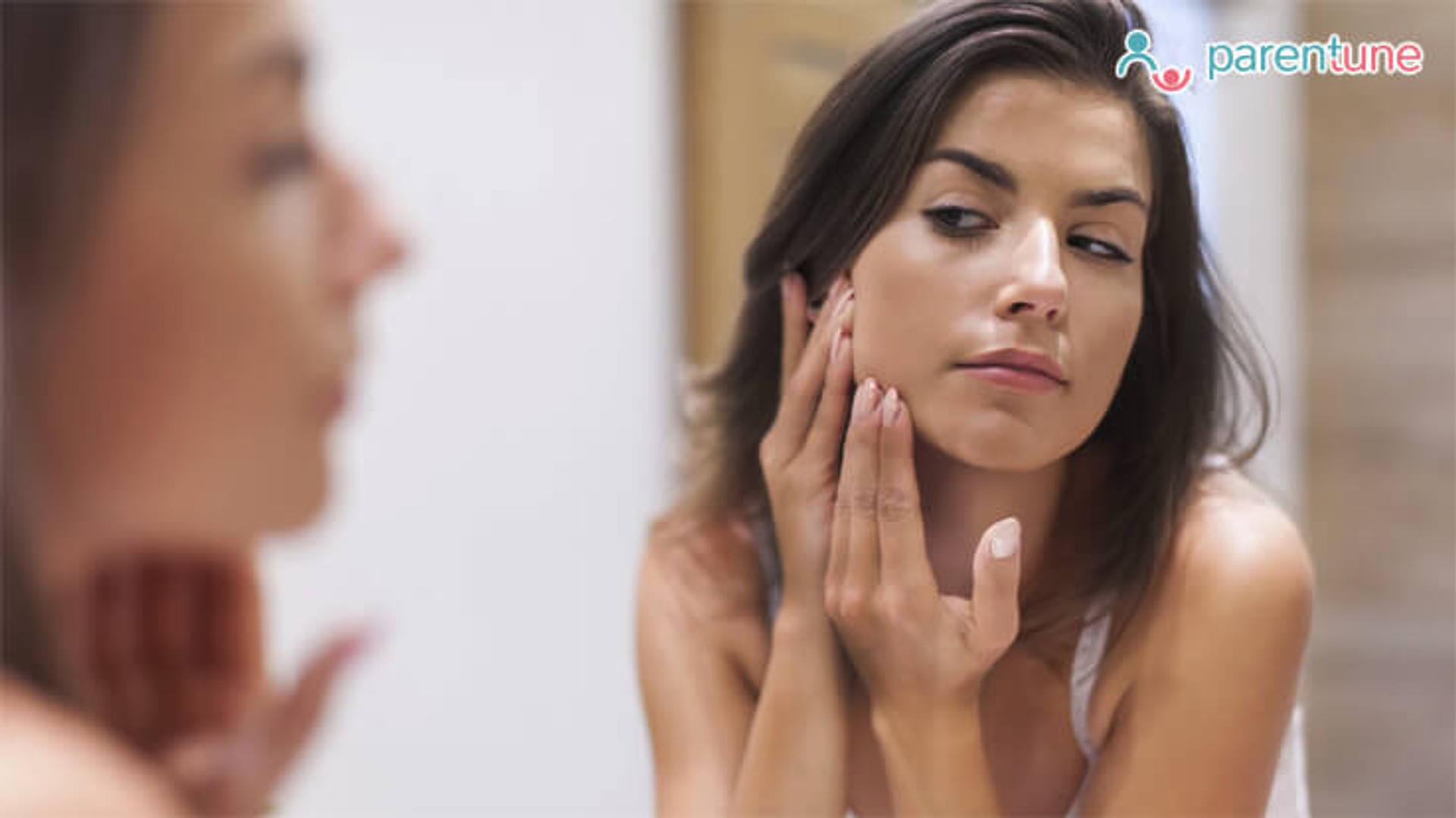Acne In Pregnancy - How To Treat It?