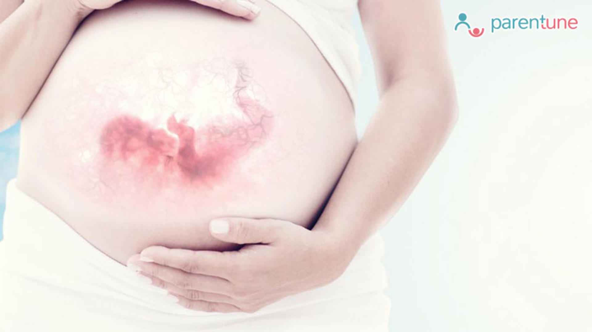 Antenatal Screening For Genetic Disorders In Yet-To-Be-Born Baby