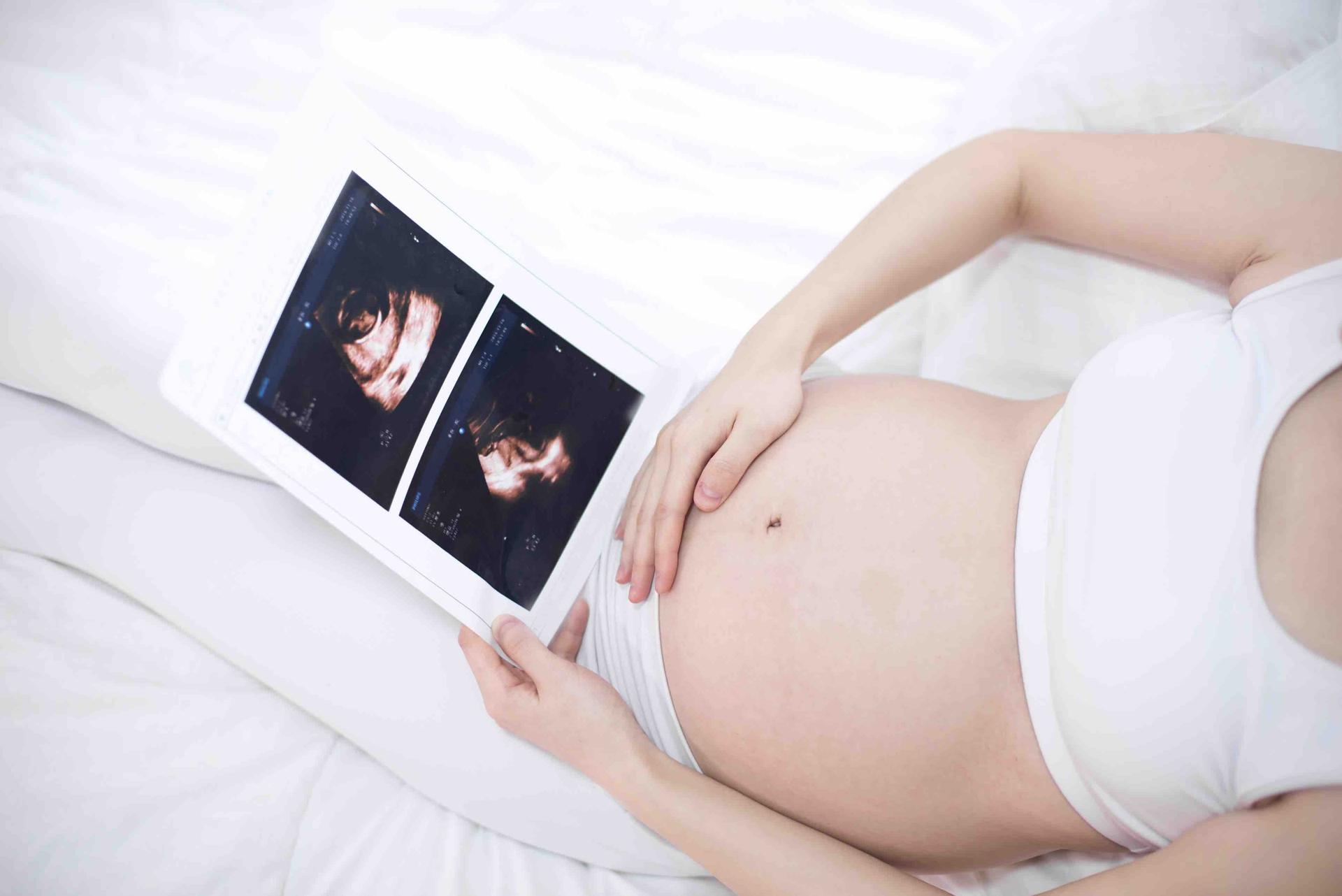 Ectopic pregnancy: Symptoms, causes, risks, treatment, and more