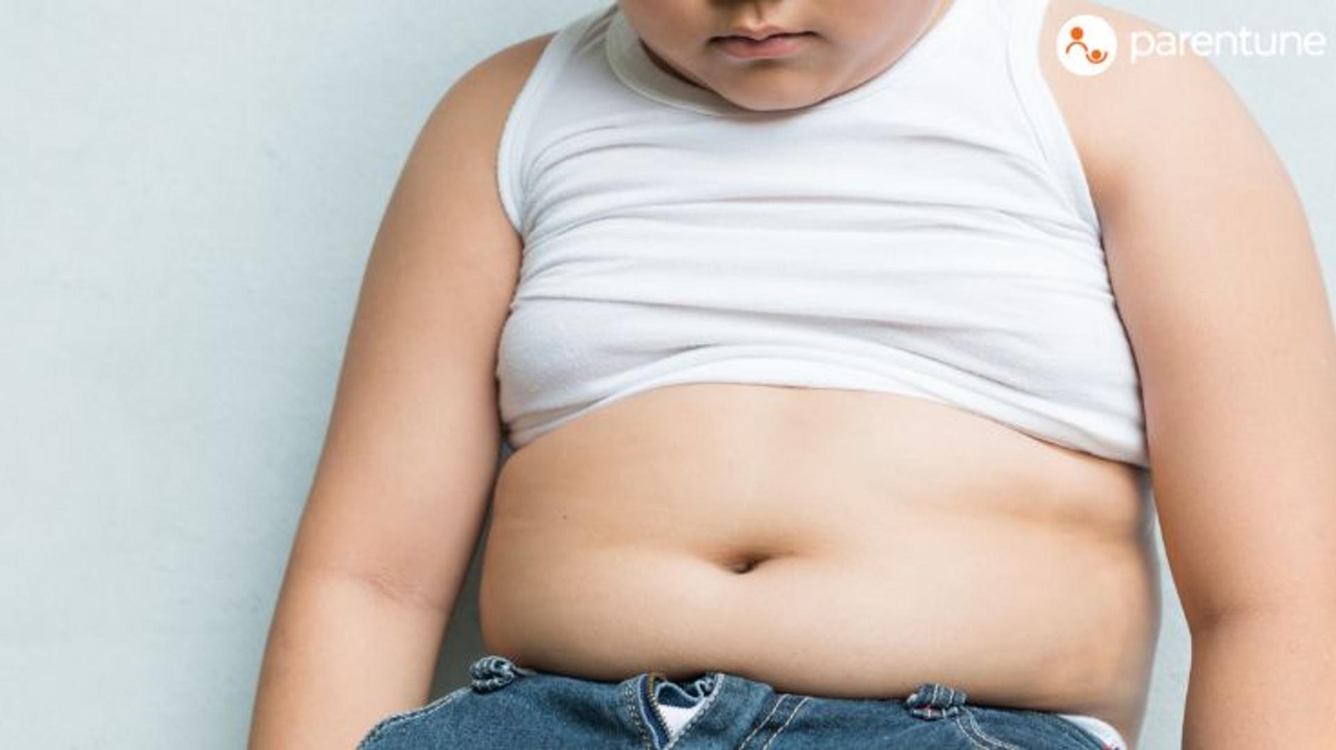 Health Risks & Causes Of Childhood Obesity: Preventive Measures That Can Help