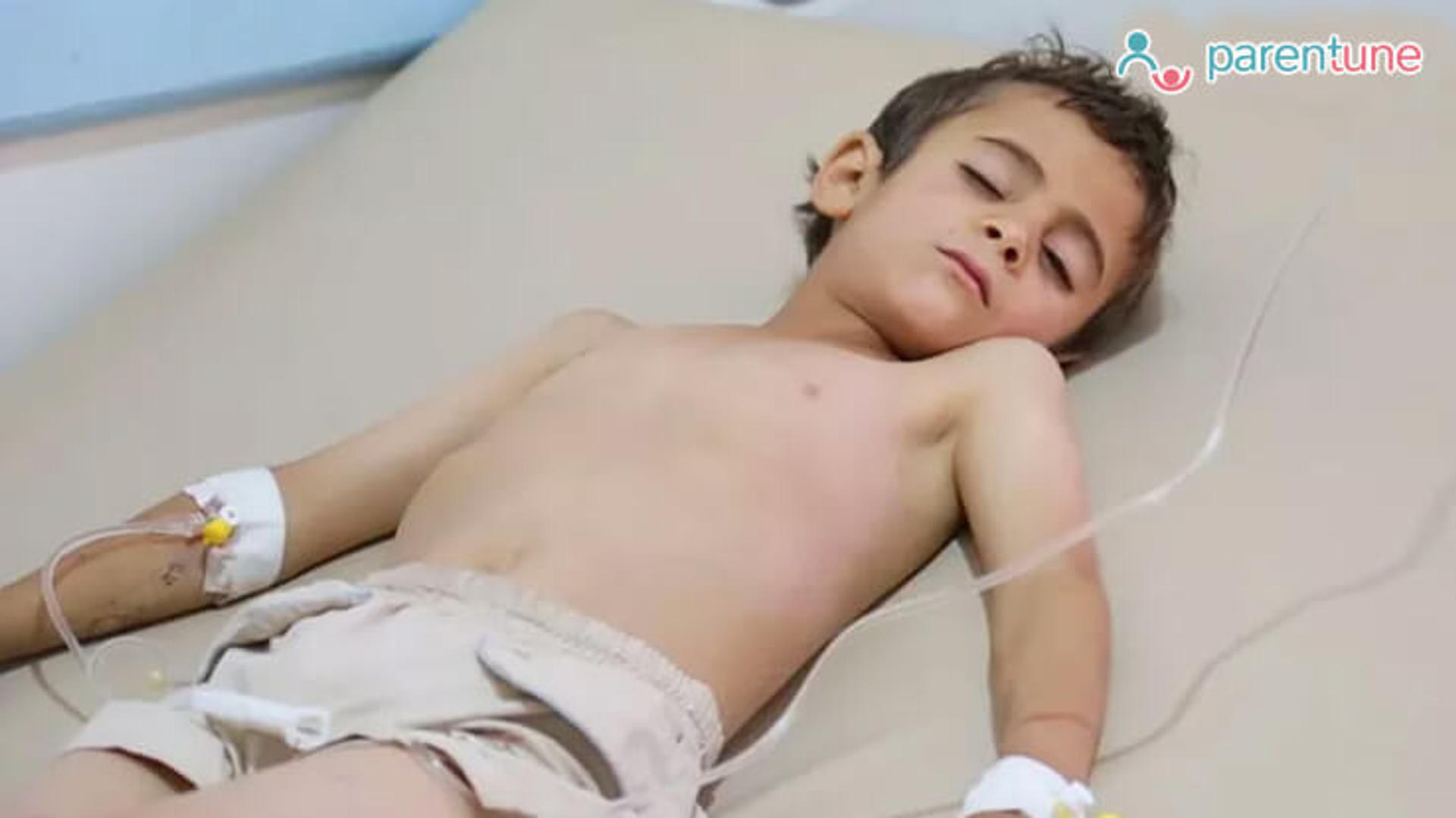 Hernia Causes, Types and Symptoms in Children