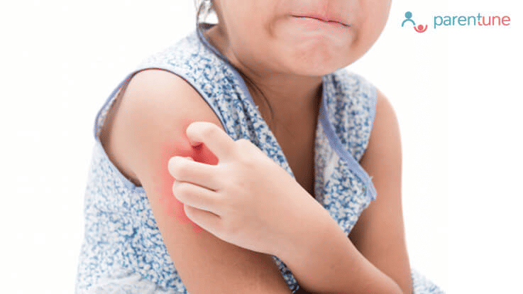What Can Cause Eczema? How to Treat Eczema in Toddlers