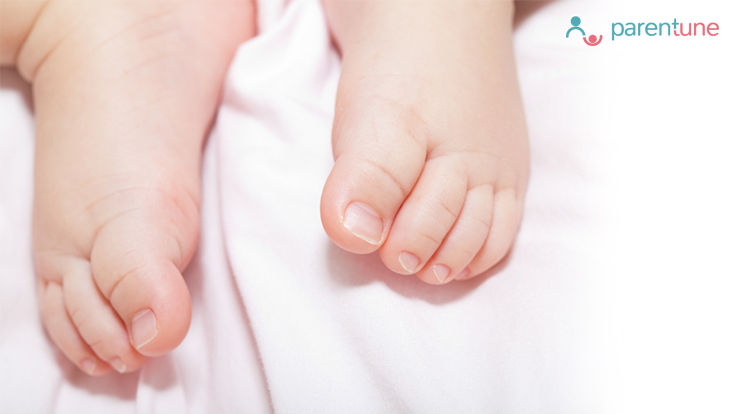 Have you noticed that your newborn baby's feet are turned in