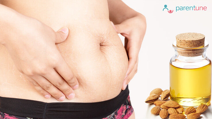 Parentune Is Almond Oil Good For Stretch Marks During And After Pregnancy