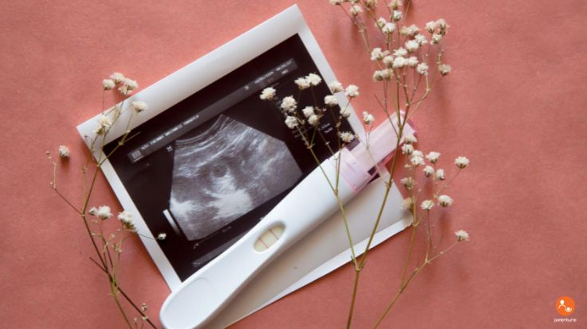 Know What Tests You'll Need During Pregnancy