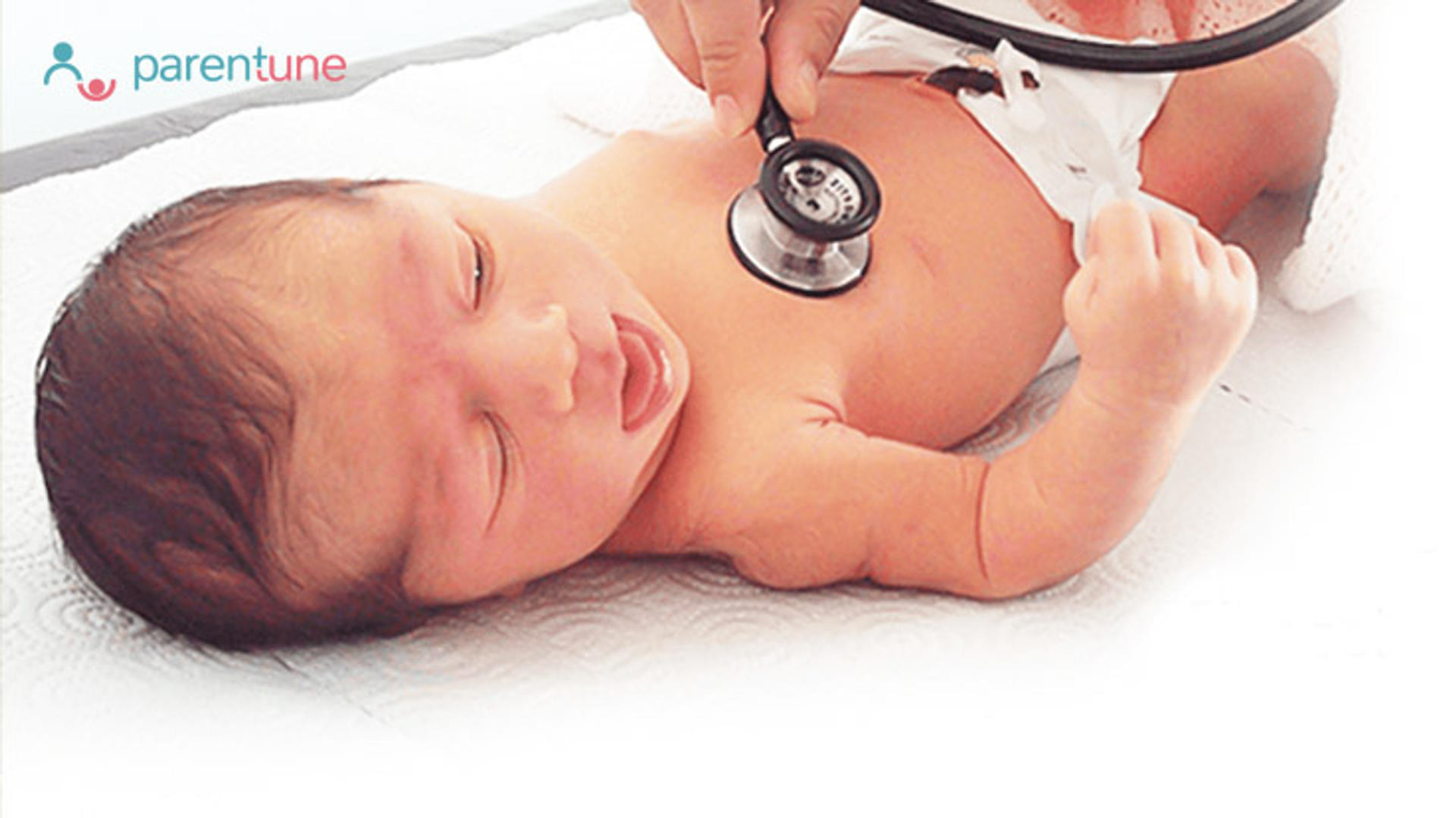 Neonatal Jaundice In Your Newborn Baby - Symptoms, Causes & Remedies