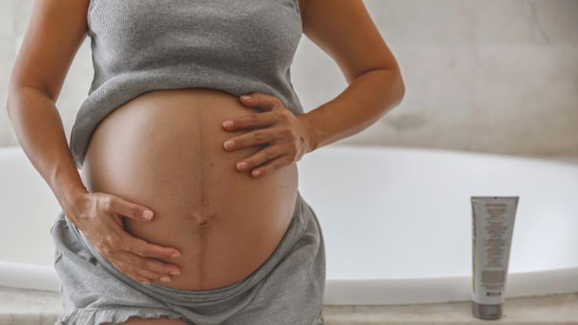 Pregnancy Stretch Marks: Causes, Prevention, Home Remedies, Creams & Oils