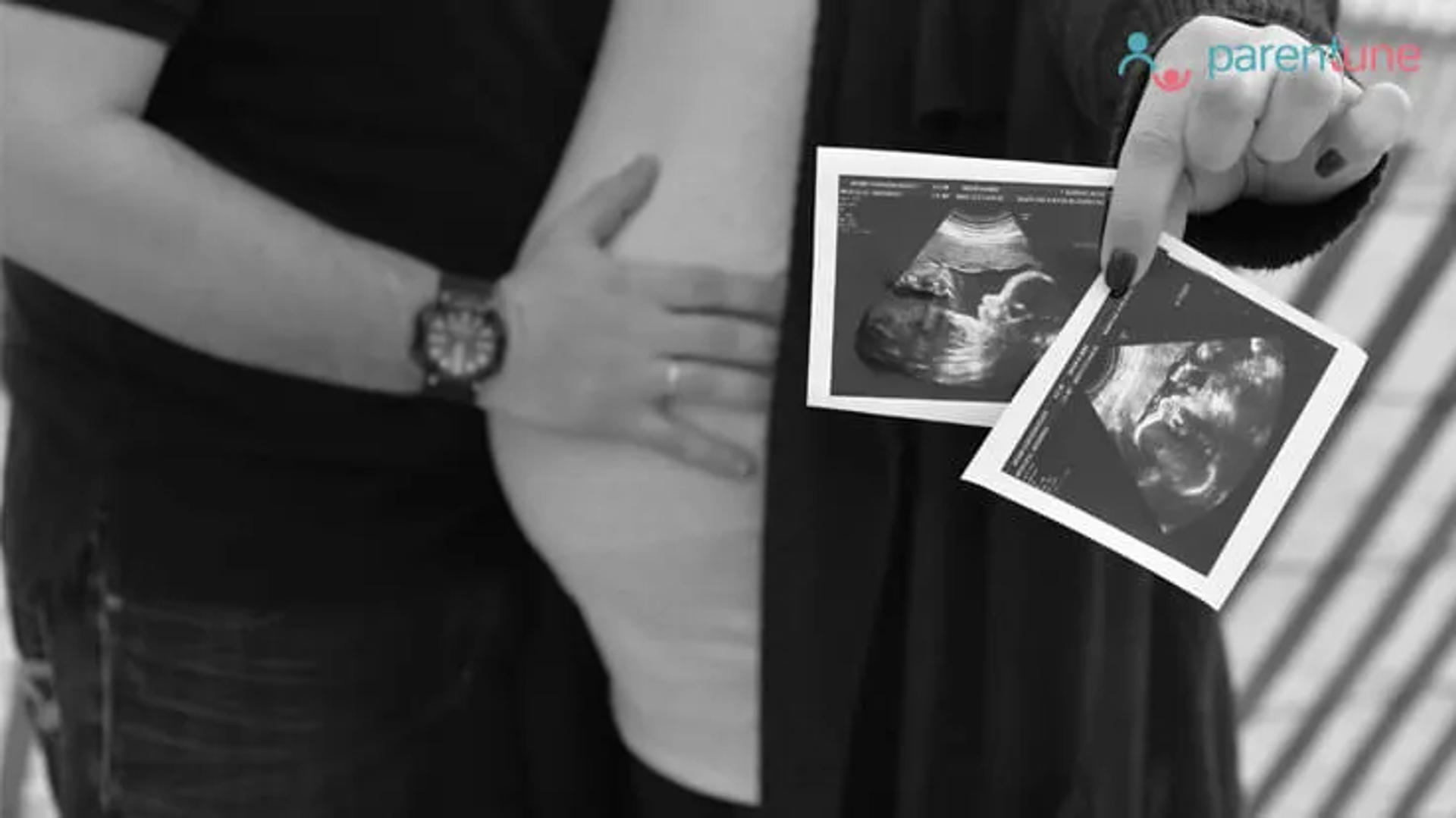 Twin Pregnancy Symptoms, Complications, Fetal Development Week by Week