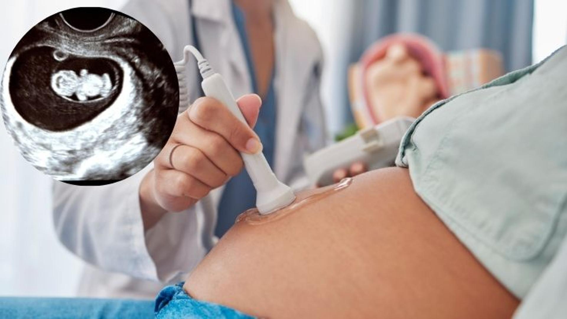 Ultrasound Scans During Pregnancy: Know When & Why You Need Them