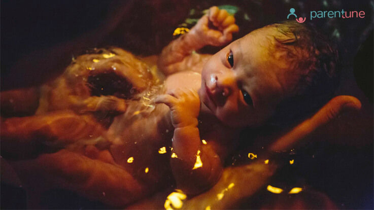 Ways To Protect Your Babys Umbilical Stump Ways To Protect Your Babys Umbilical Stump