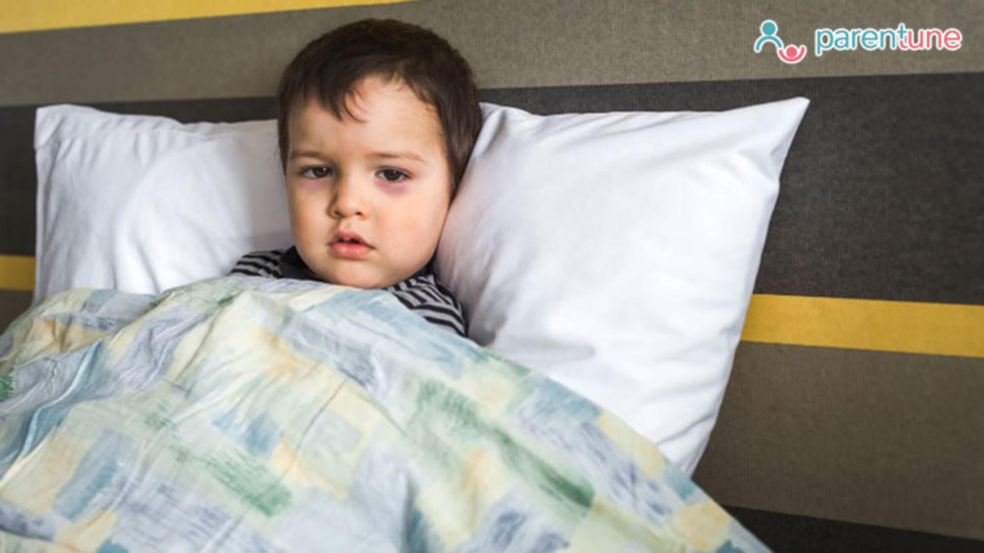 Baby’s Head is Hot, But No Fever: Causes, Solution, When to See a Doctor