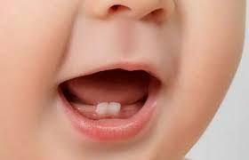 बाळाला दुधाचे दात येताना घ्यावयाची काळजी बाळाला दुधाचे दात येताना घ्यावयाची काळजी