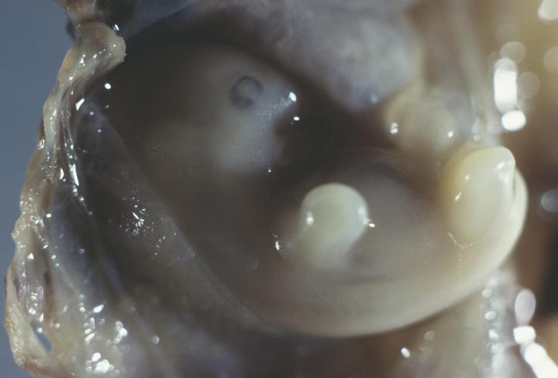 6 Weeks 4 Days Pregnant - Your Baby's Lungs & Limbs Are Forming Today