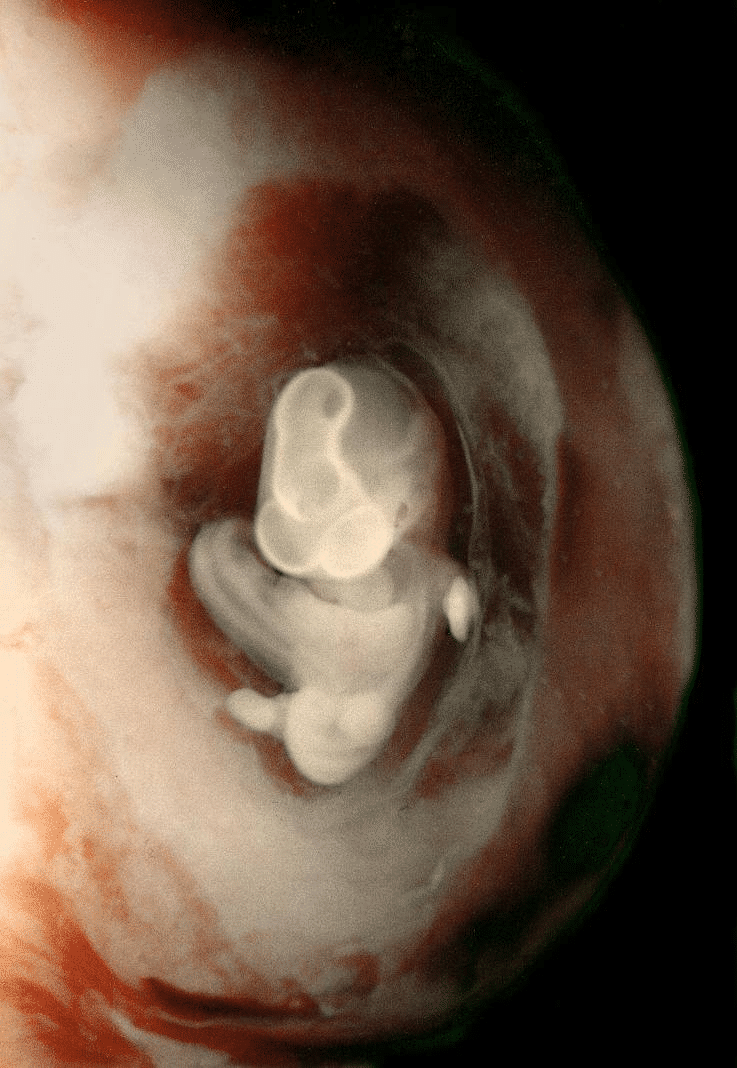 7 weeks and 7 days pregnant - Baby Fetal Progress, Ultrasound