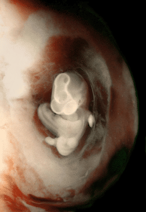 7-weeks-and-7-days-pregnant-baby-fetal-progress-ultrasound