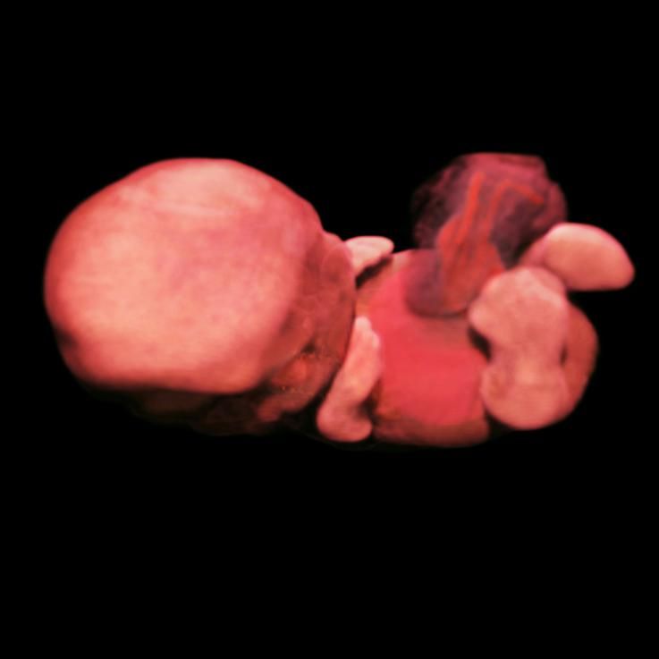 Ultrasound pregnant 8 weeks 8 week