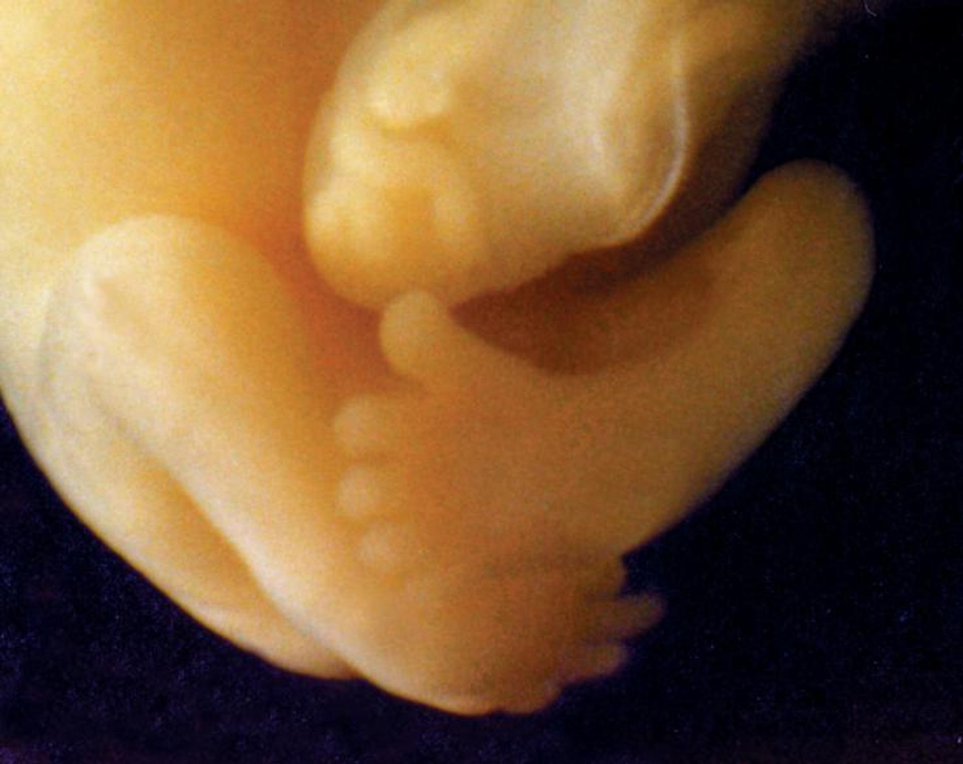 Week-by-Week Pregnancy: 9 Weeks 5 Days Explained