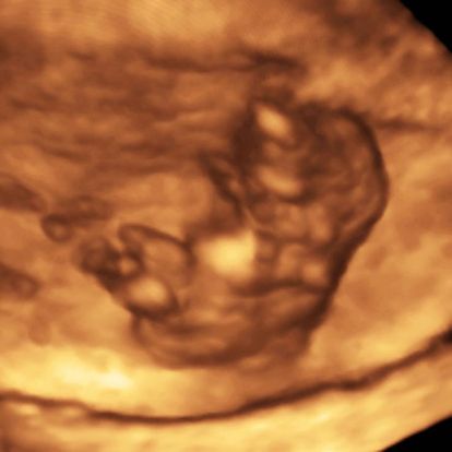 16-weeks-and-6-days-pregnant-baby-fetal-progress-ultrasound