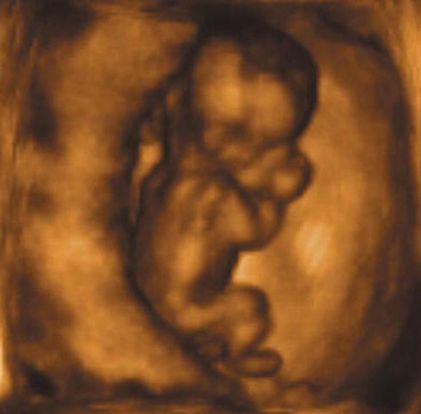 14-weeks-and-4-days-pregnant-baby-fetal-progress-ultrasound