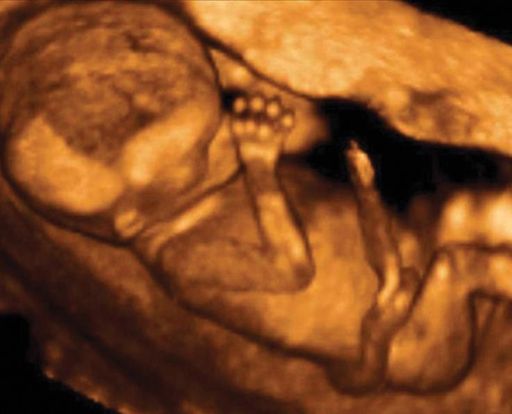 14-weeks-and-5-days-pregnant-baby-fetal-progress-ultrasound