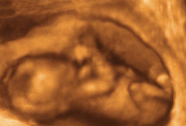 15-weeks-and-6-days-pregnant-baby-fetal-progress-ultrasound