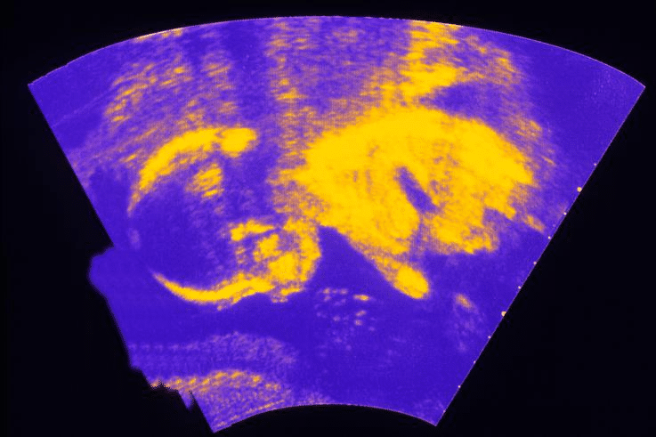 16 weeks and 2 days pregnant - Baby Fetal Progress, Ultrasound