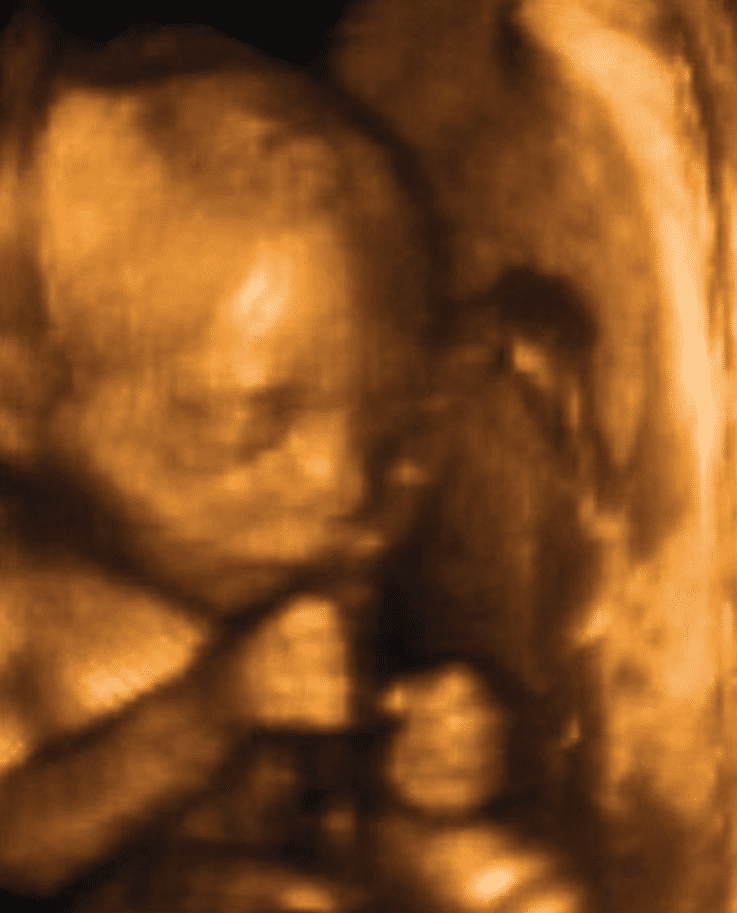 23-weeks-and-1-day-pregnant-baby-fetal-progress-ultrasound