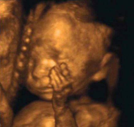 25-weeks-and-5-days-pregnant-baby-fetal-progress-ultrasound