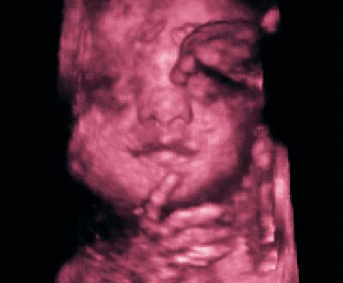 25 weeks pregnant ultrasound