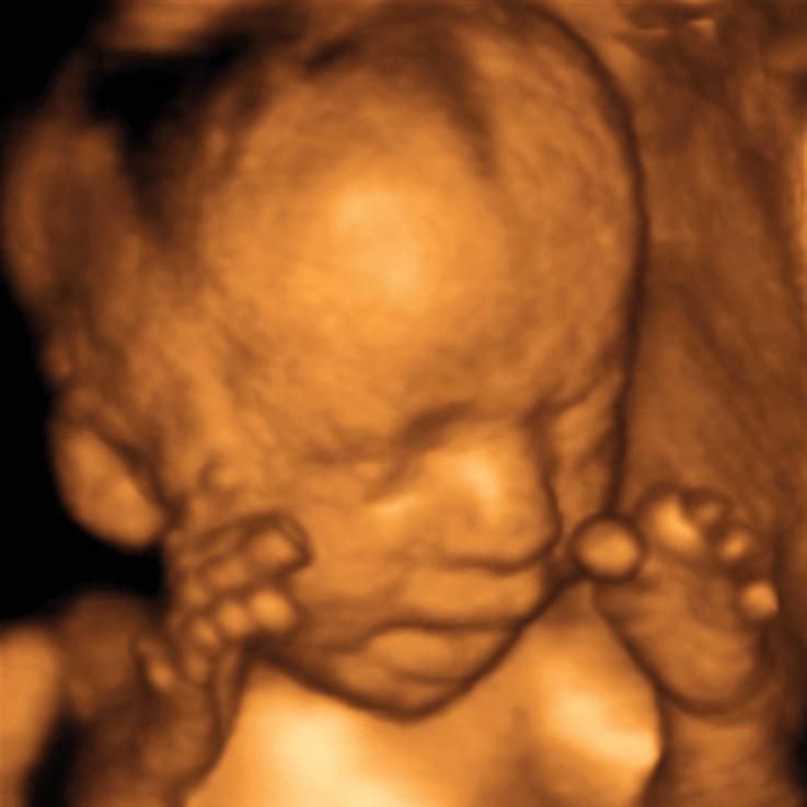 4d ultrasound pictures at 27 weeks