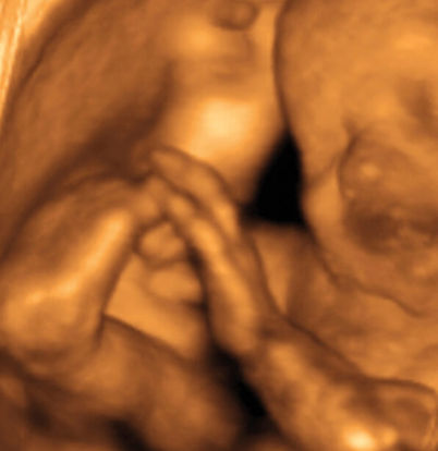 29 weeks fetus ultrasound