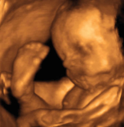 29 weeks ultrasound