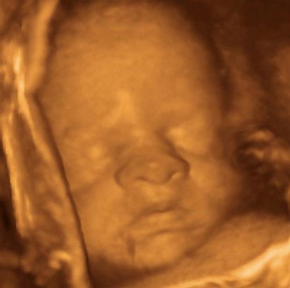 30-weeks-and-4-days-pregnant-baby-fetal-progress-ultrasound