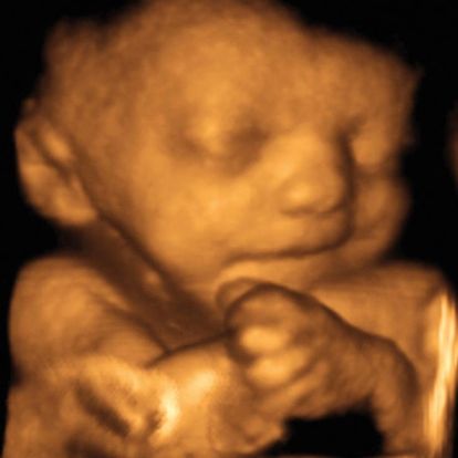 32-weeks-and-2-days-pregnant-baby-fetal-progress-ultrasound