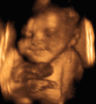 32 weeks ultrasound