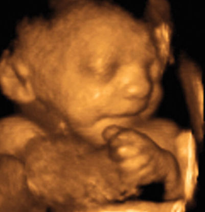 32 weeks ultrasound