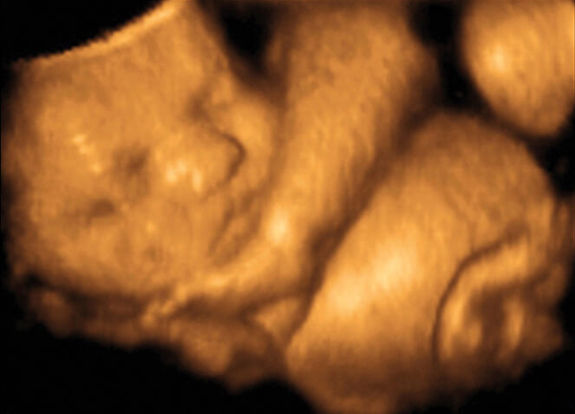 33-weeks-and-5-days-pregnant-baby-fetal-progress-ultrasound