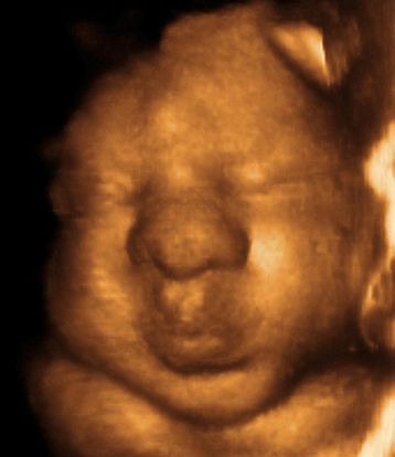 35-weeks-and-6-days-pregnant-baby-fetal-progress-ultrasound