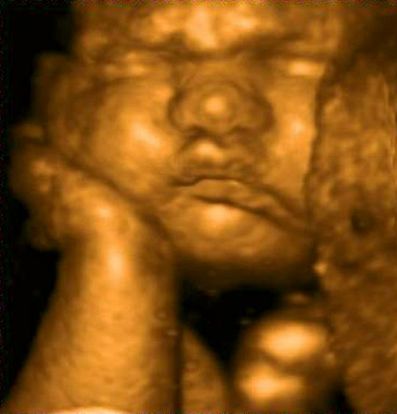 36-weeks-and-3-days-pregnant-baby-fetal-progress-ultrasound