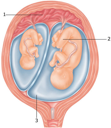 fraternal twins in the womb at 10 weeks