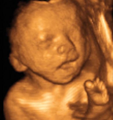 24 weeks pregnant 4d ultrasound